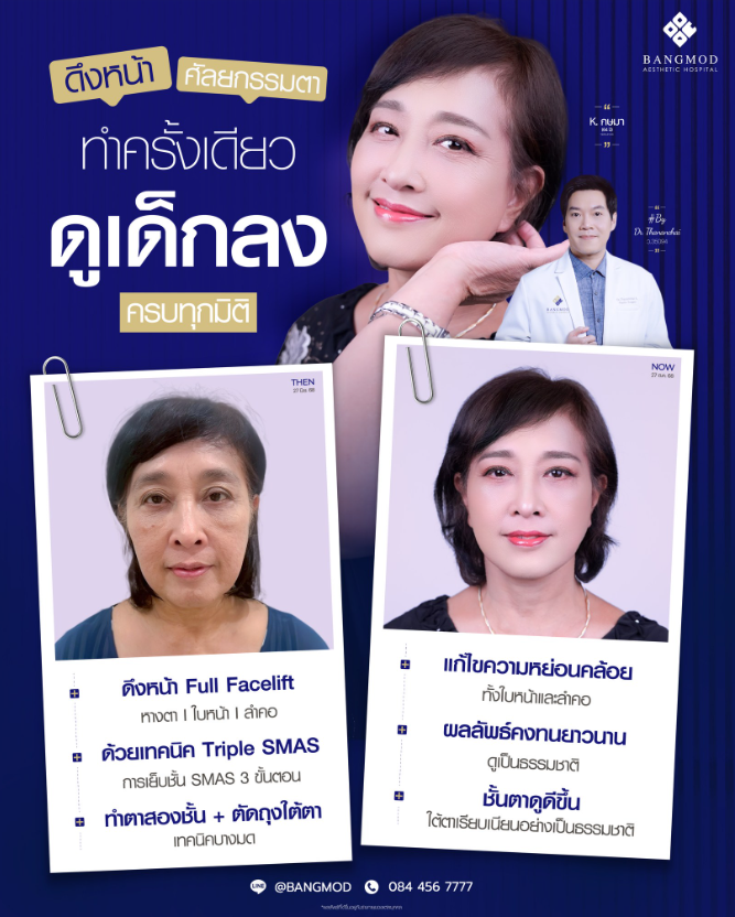 Bangmod Aesthetic Hospital Before and After 4