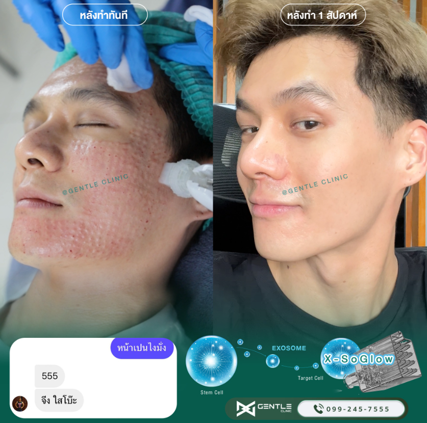 Gentle clinic before and after 1