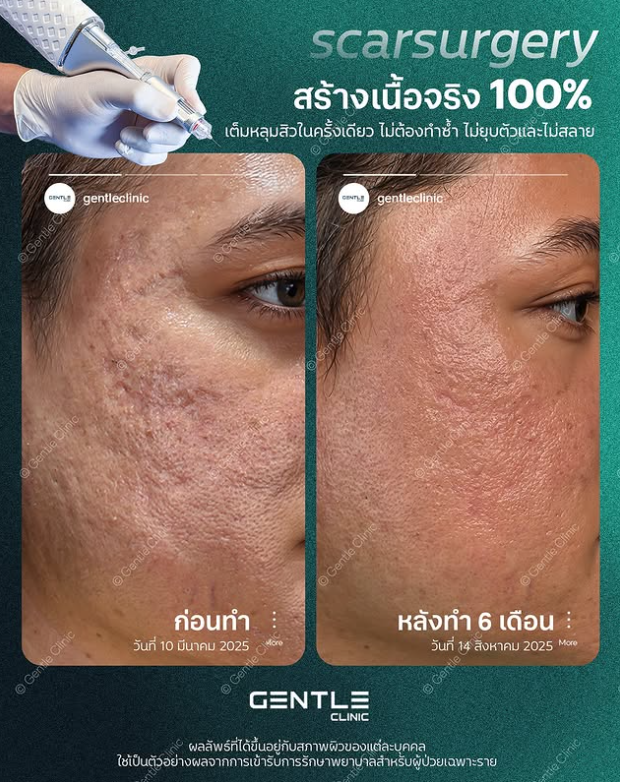 Gentle clinic before and after 2