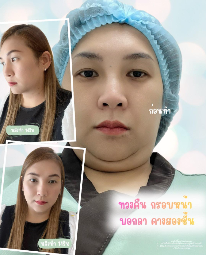 Little clinic before and after 1