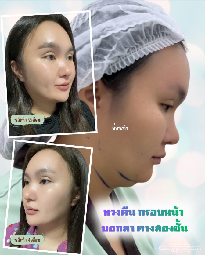 Little clinic before and after 2