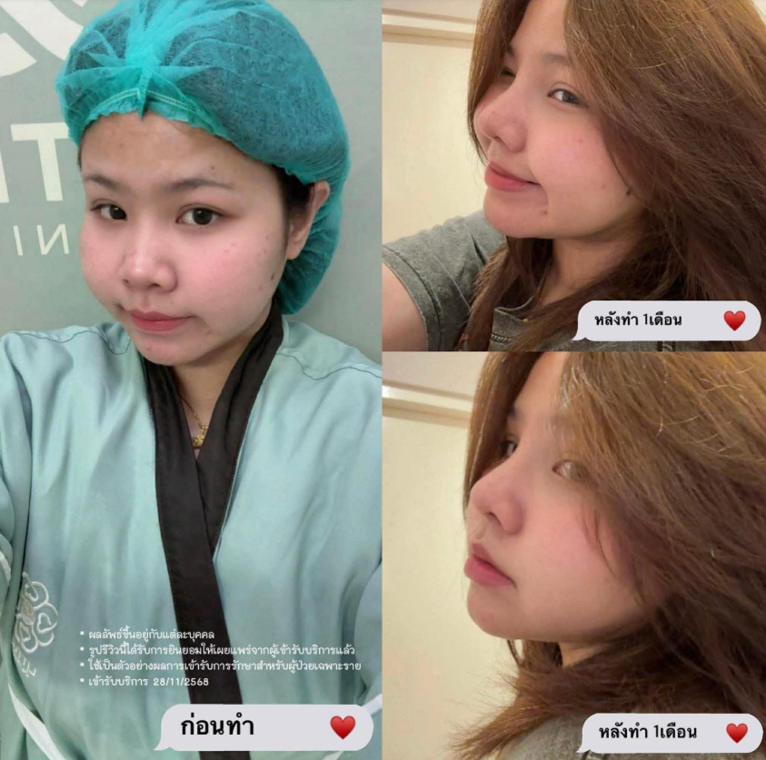 Little clinic before and after 3