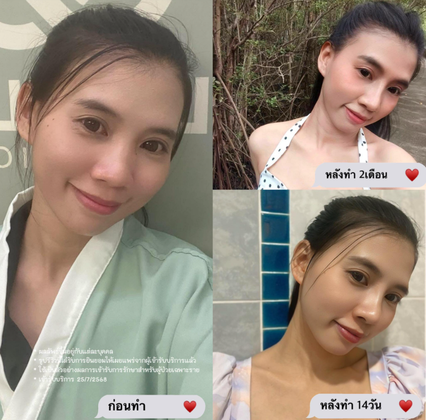 Little clinic before and after 4