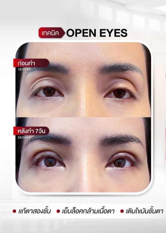 Luxury Clinic before and after 1