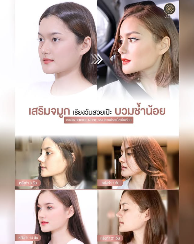 Luxury Clinic before and after 4