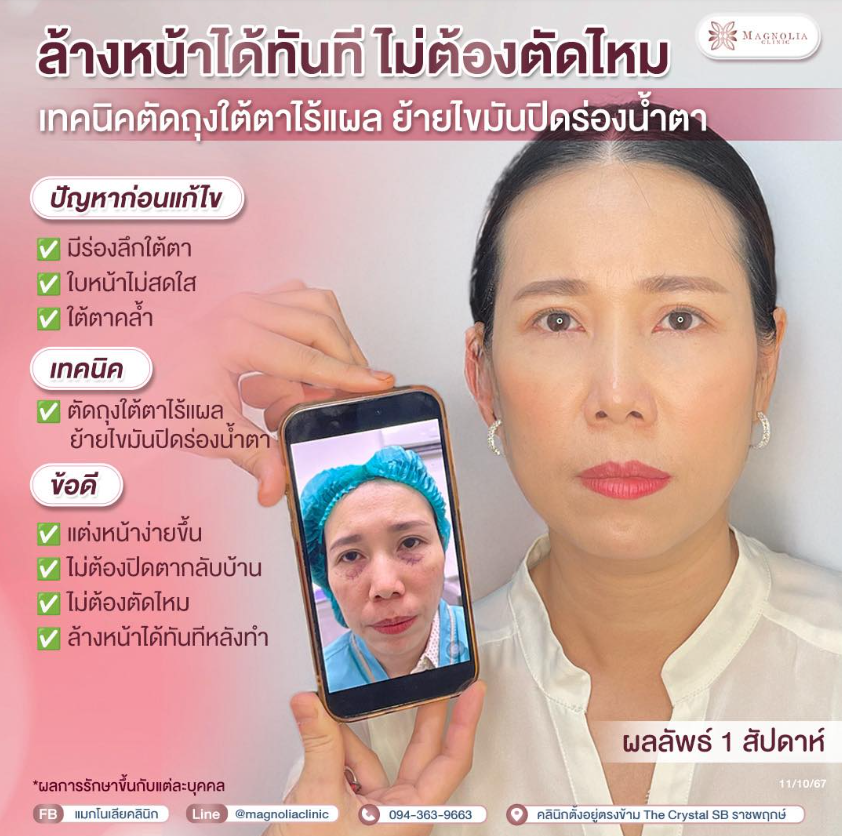 Magnolia Clinic before and after 1