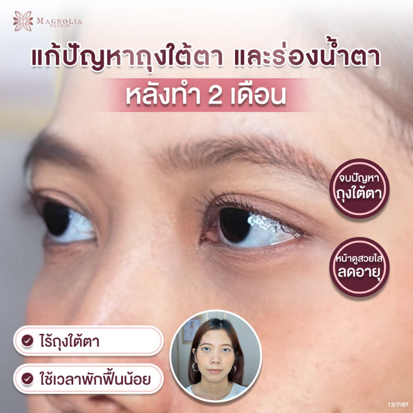 Magnolia Clinic before and after 4