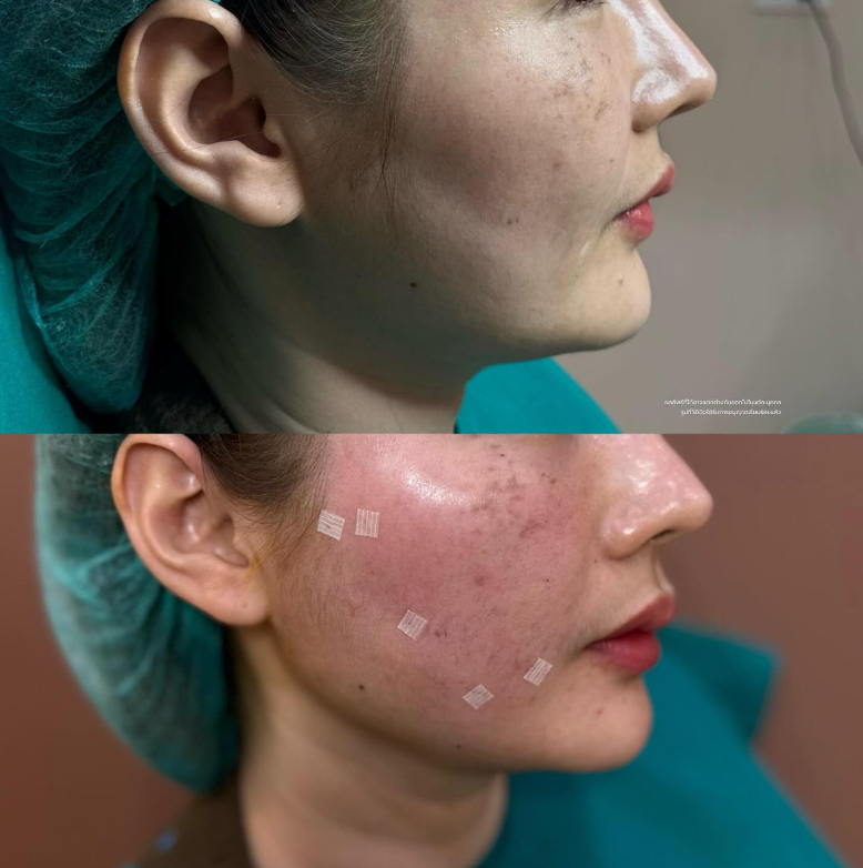 Mose Wellness clinic before and after 2