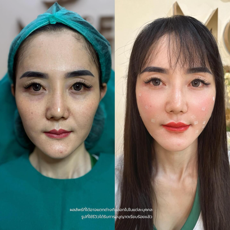 Mose Wellness clinic before and after 4