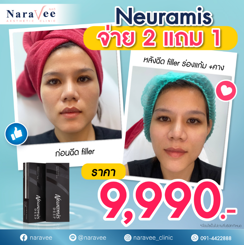 Naravee Clinic before and after 1