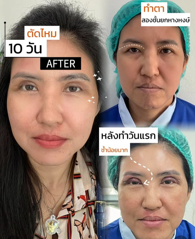 S.T. Medical Clinic before and after 1