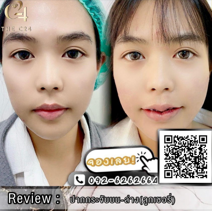 The C24 Clinic before and after 2