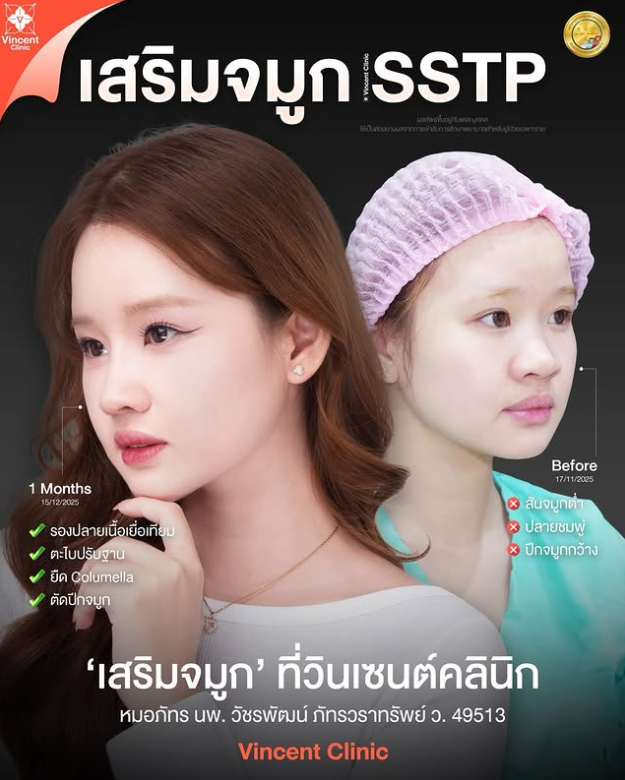 Vincent Clinic before and after 1