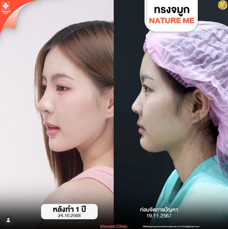 Vincent Clinic before and after 3