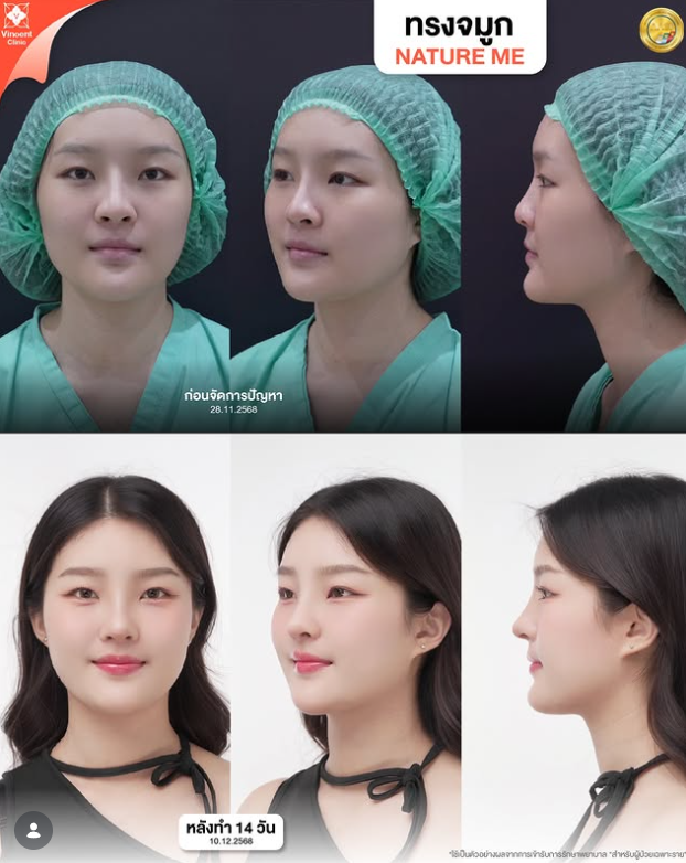 Vincent Clinic before and after 5