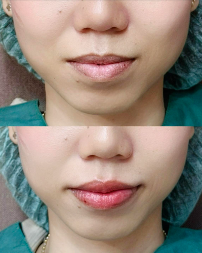 Wan Suk Clinic before and after 1