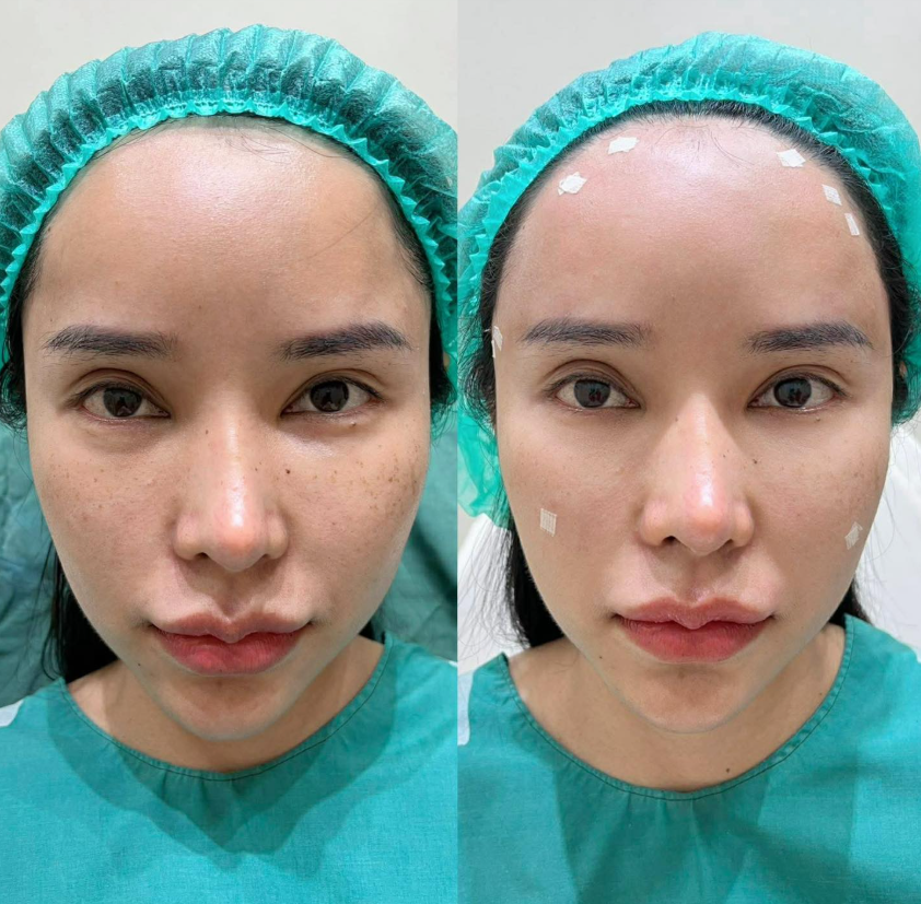 Wan Suk Clinic before and after 3