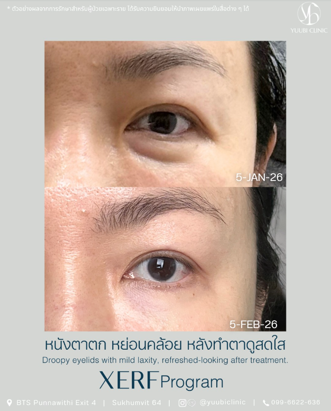 Yuubi clinic bafore and after 1