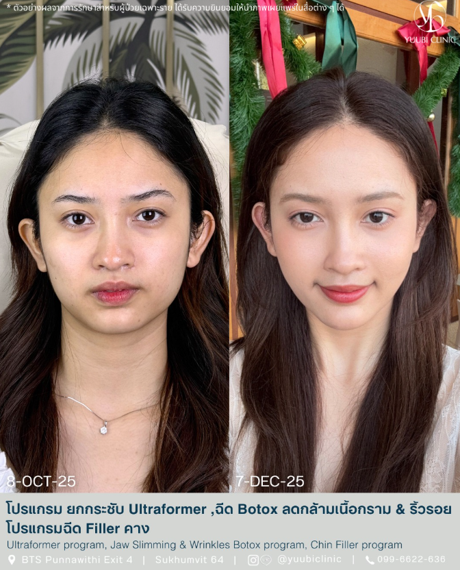 Yuubi clinic bafore and after 3