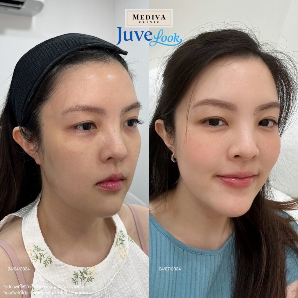 481051738_954053216831910_5932336618660204812_n