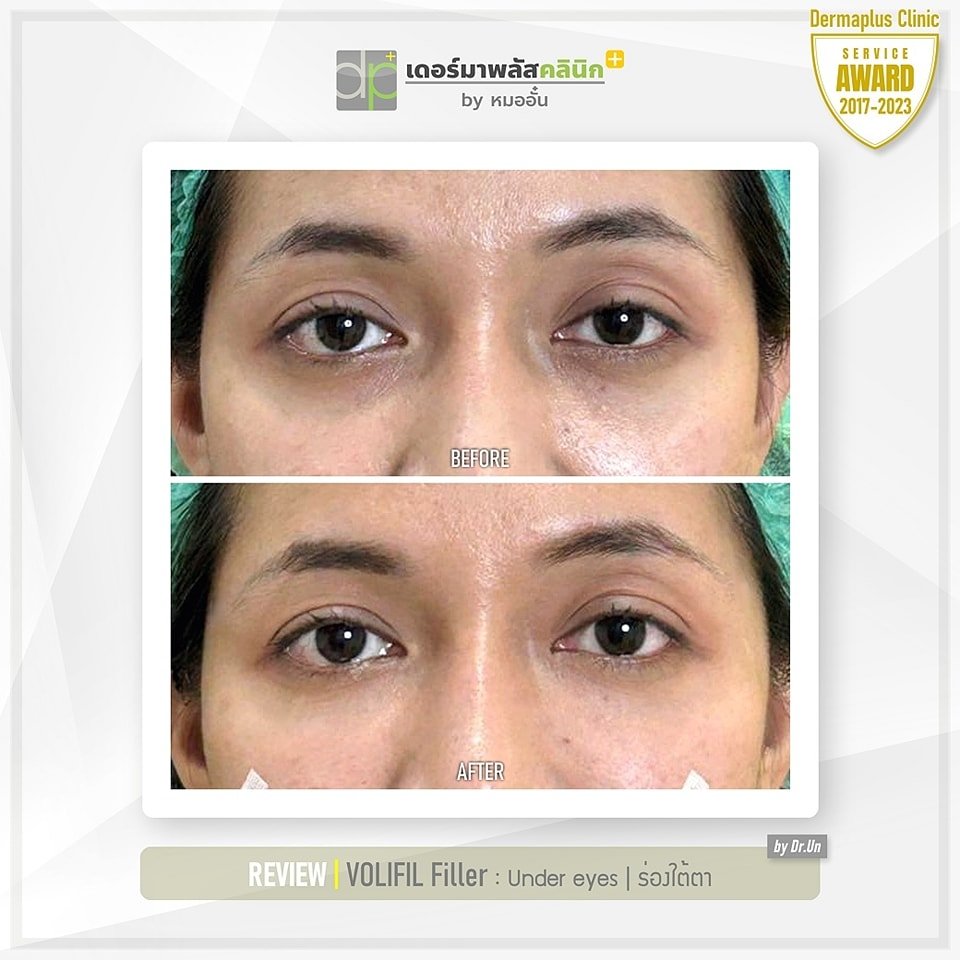 481164994_1186036716219681_7531581594659596234_n