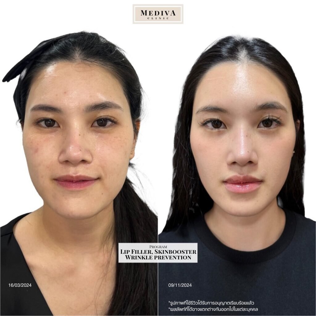 482150467_18487860547016421_3810838027218775814_n