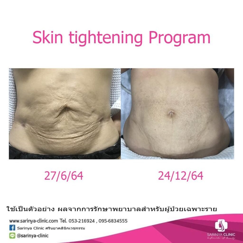 484853351_1024362549728755_2774573468962265497_n