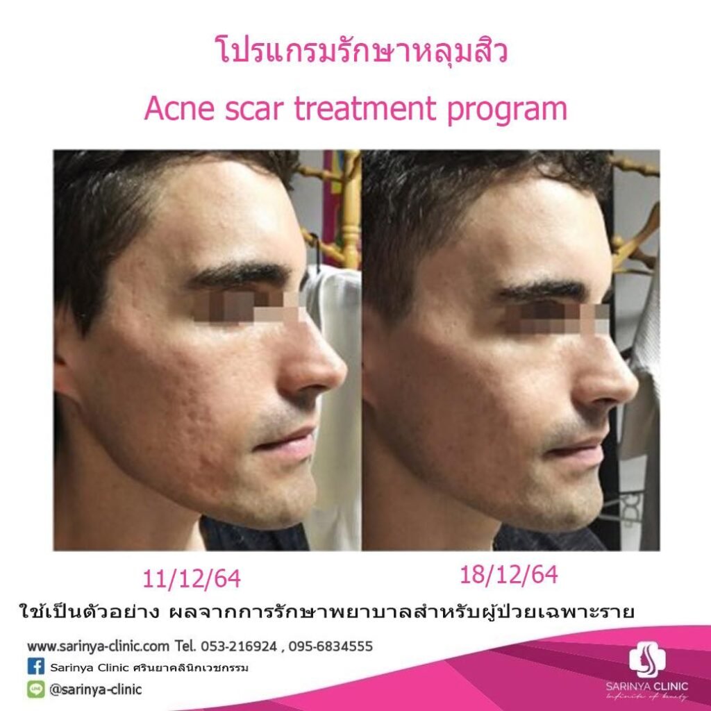 485285671_1023947276436949_1451516226088298727_n