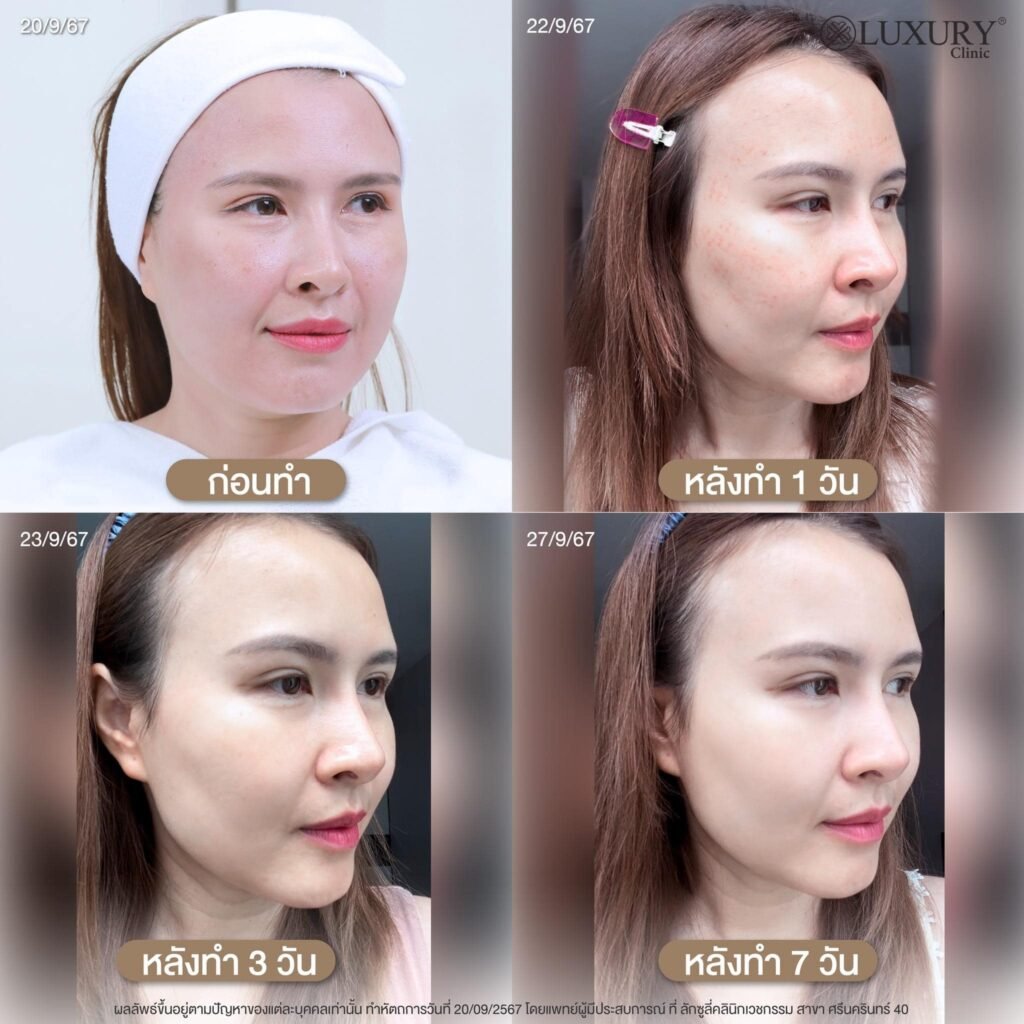 491917860_1231539918974020_8186665993968621154_n