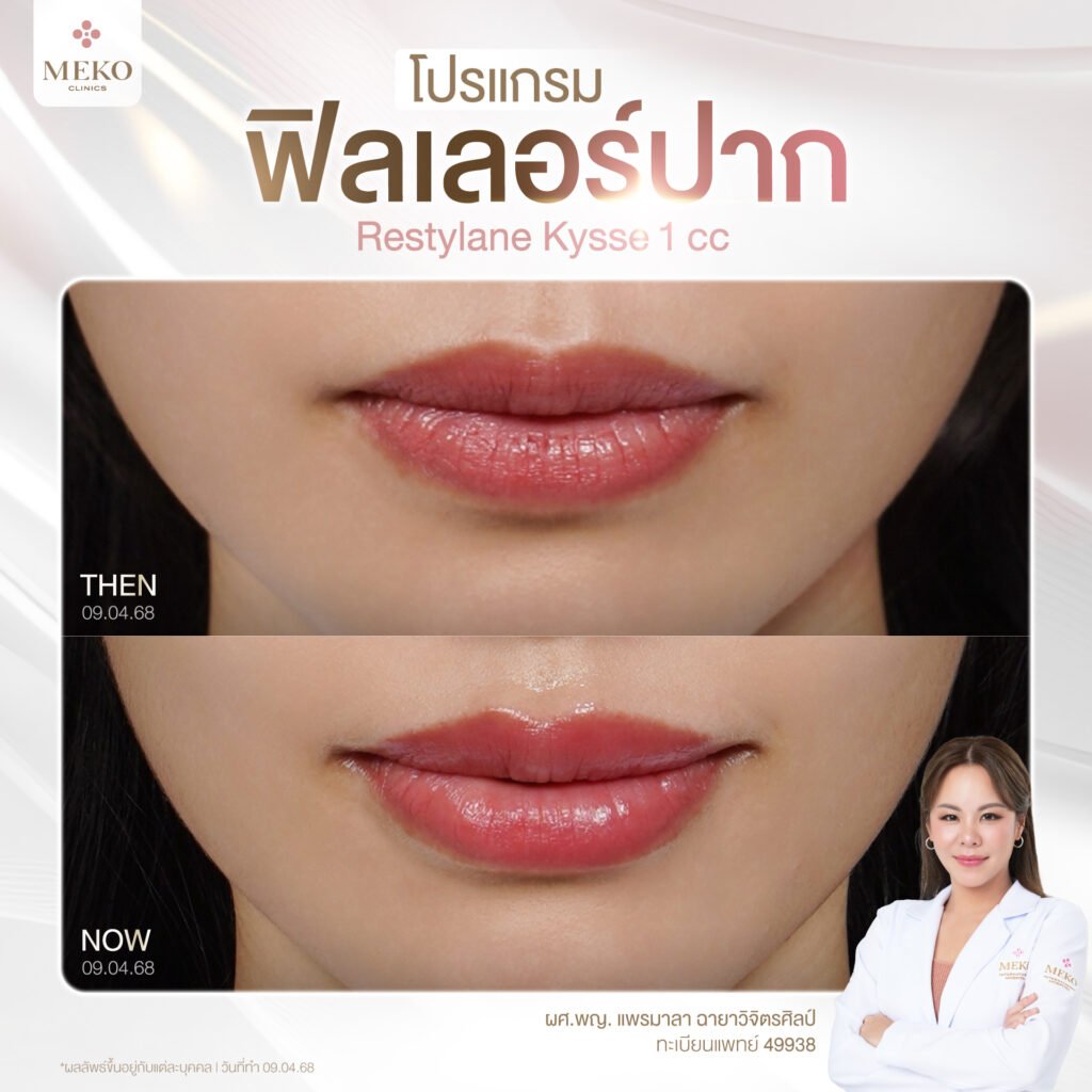 499271372_122210729450247461_4226895045165878757_n