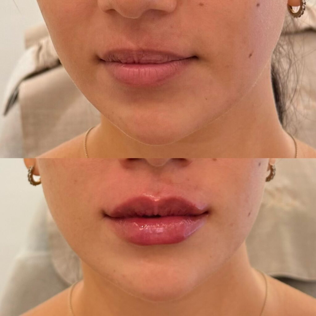 500488993_699421259545124_218513715209452213_n