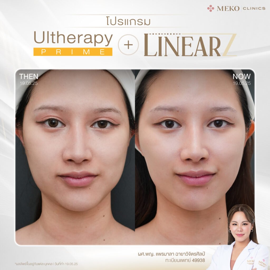 508472848_122215739108247461_1056501288698395976_n