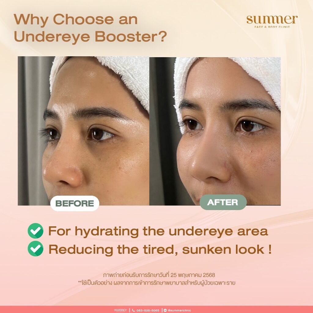 519975365_18051346181616237_585943024690290660_n