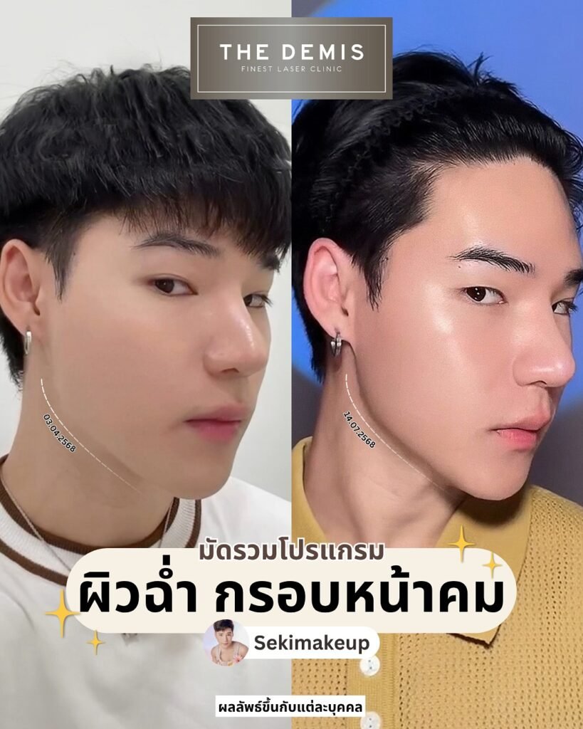 523476820_18515039182057092_6946352122363853372_n