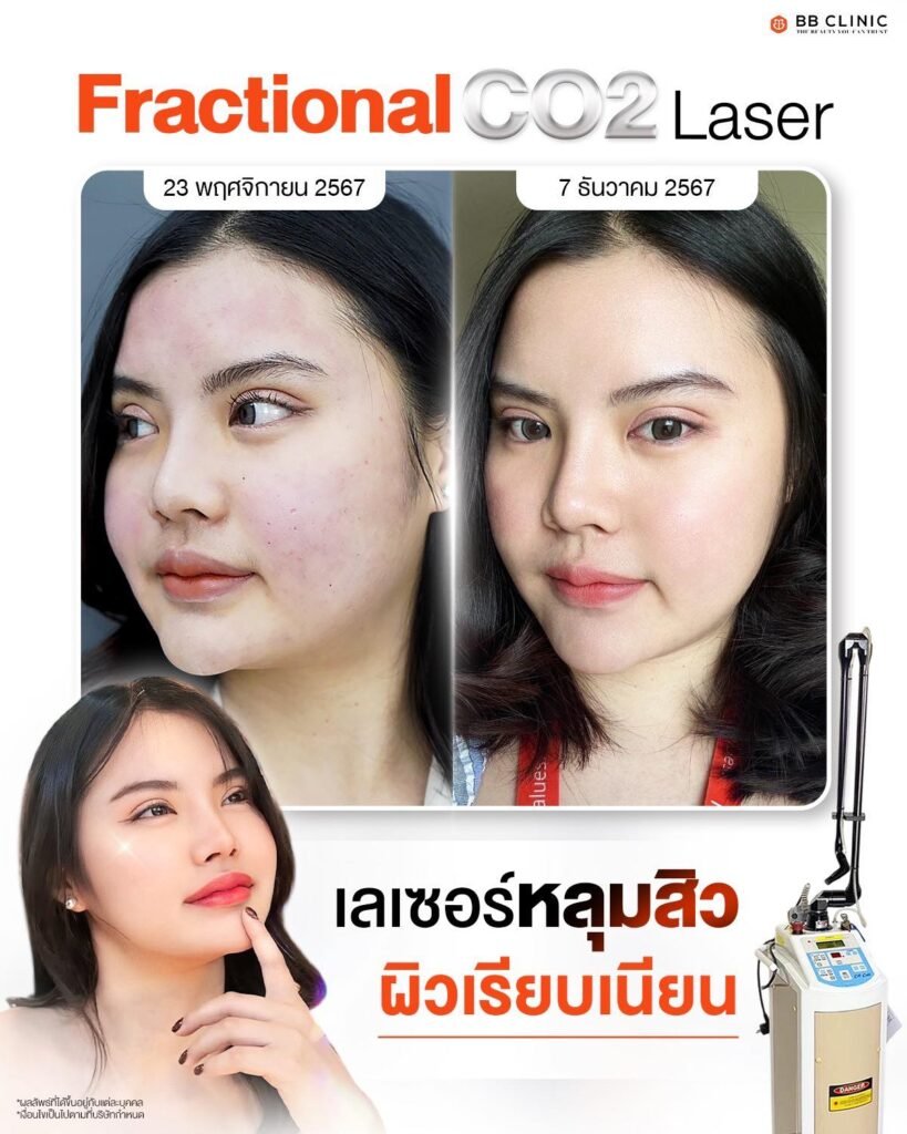 529350779_1168077822016284_1596559524100708428_n