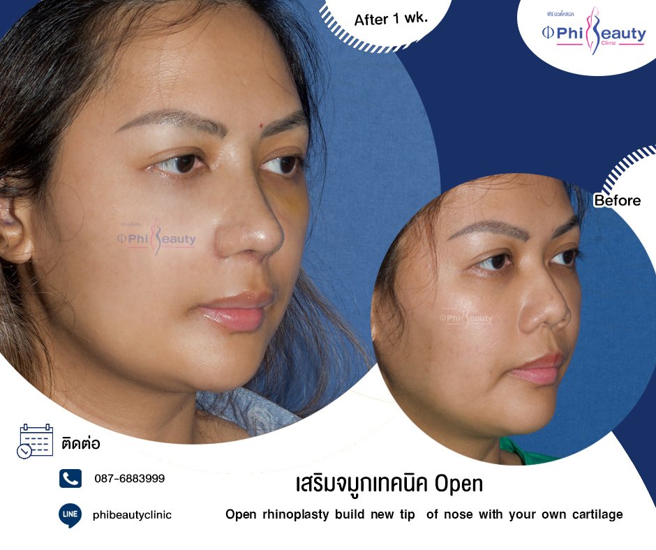 534827822_1193169536174849_2794523836707131101_n