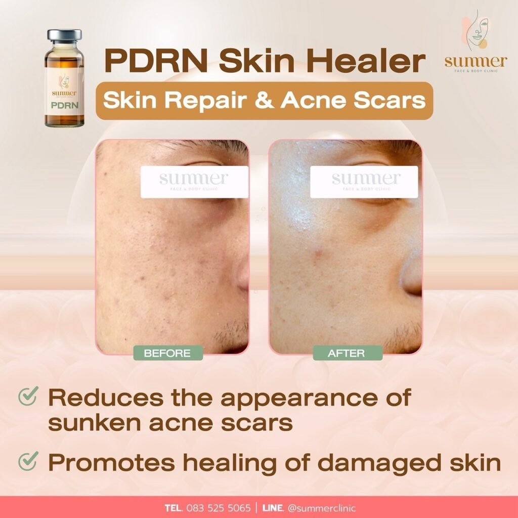 535389221_18055110959616237_1557423390825669699_n