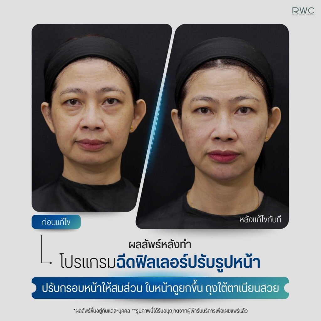 545497231_1108963388086641_1565269591172992563_n