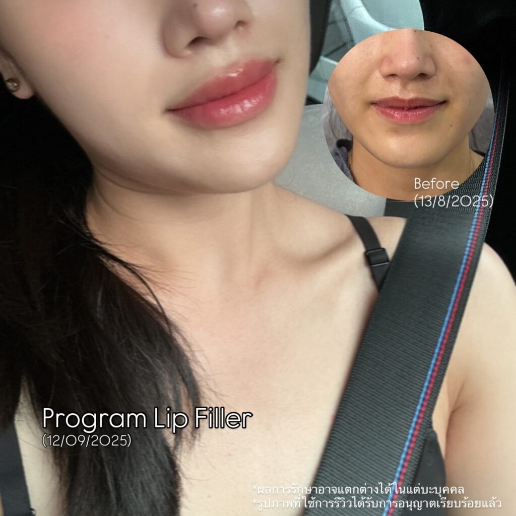 547797395_18525670576016421_2082338347959181748_n