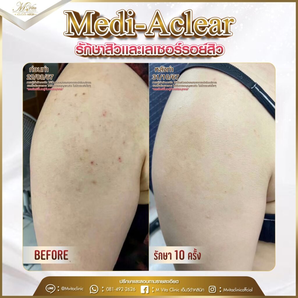 559815332_813558704386304_8207540471913931407_n