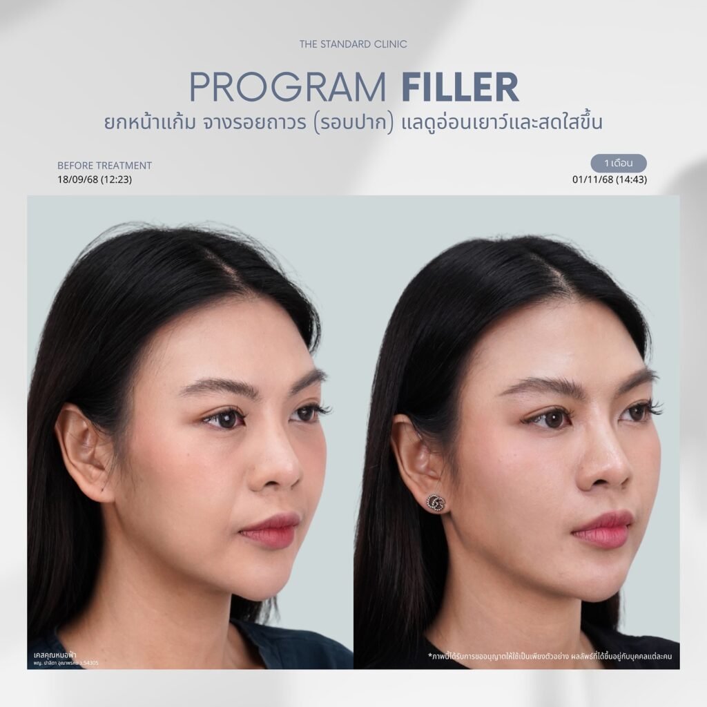 575683348_17951316285044343_436021504190722220_n