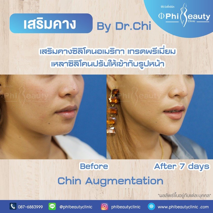 578936987_1270836475074821_4901402162092297248_n