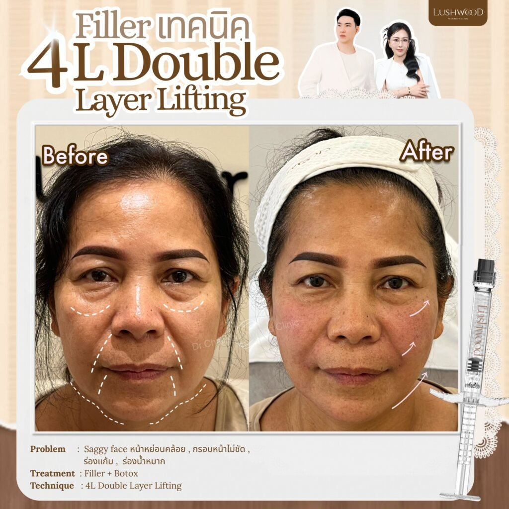 582281701_836665699154012_7940673092083691908_n