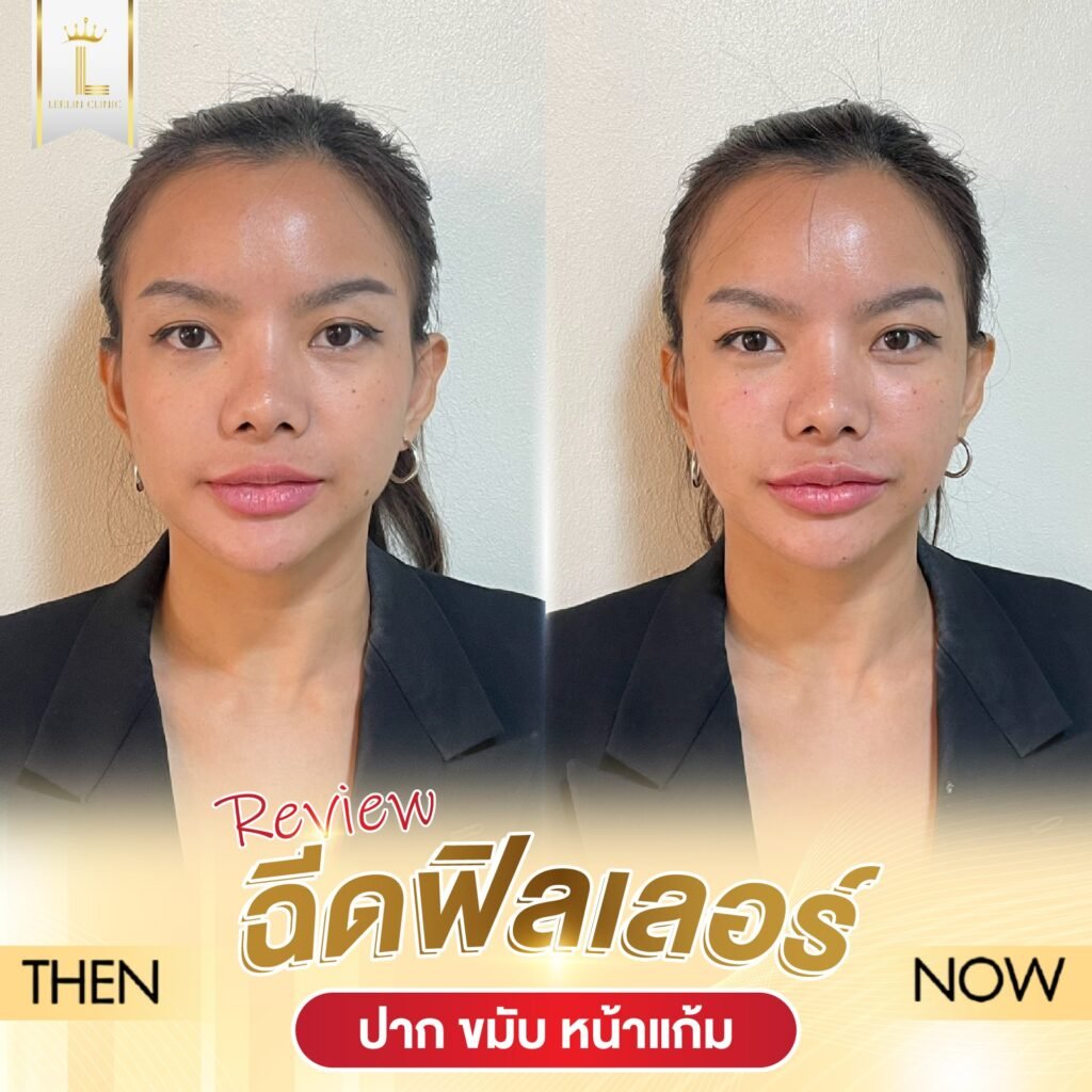 584275323_812409754940882_684926495415328106_n