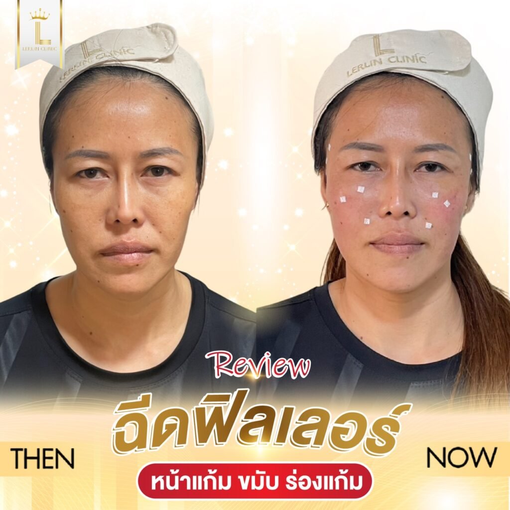 586037495_813950714786786_6493859574449257227_n