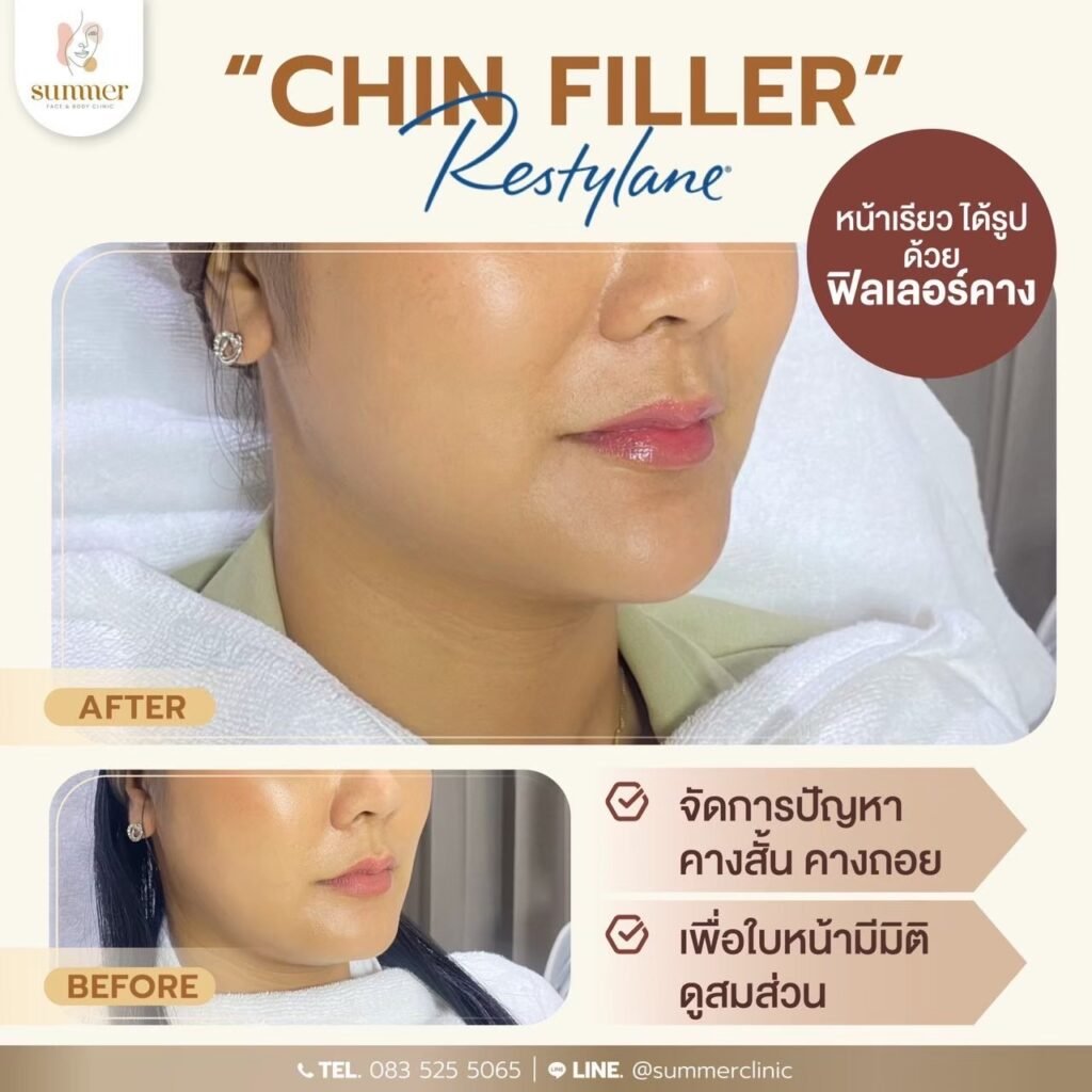 588150550_18067437755616237_2523101983727848073_n