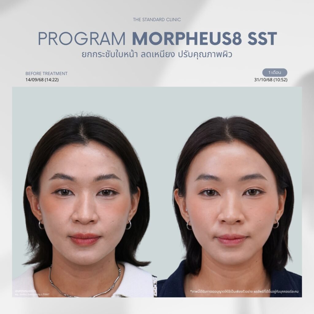 590397118_122245470164191295_7181028492351918457_n