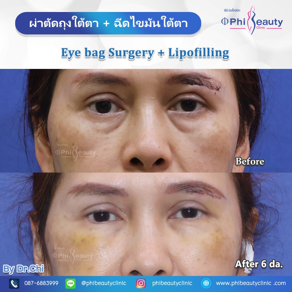 591628223_1289439843214484_43067099646086830_n