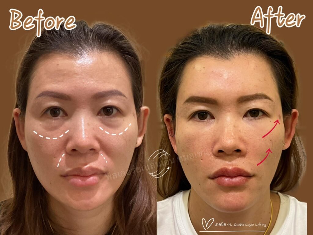 593717665_849499007870681_3126752535374710788_n