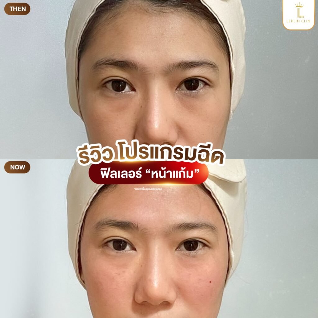 595168887_829213389927185_4376755525889315191_n